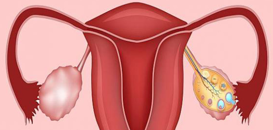 تنبلی تخمدان چه دلایلی دارد؟