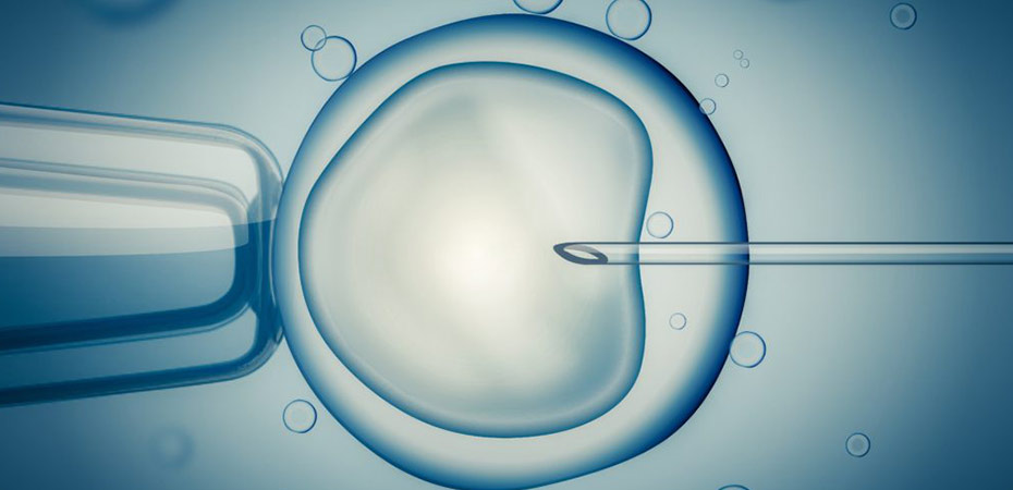 IVF ، دختردار می شوید یا پسردار؟